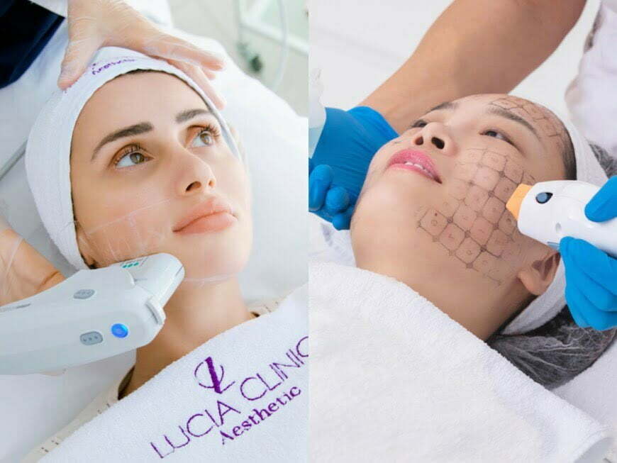 Holiday specials at Lucia Clinic, Thermage and Ultherapy - enhance your face with non-invasive and effective treatments that reduce wrinkles and firm the skin.