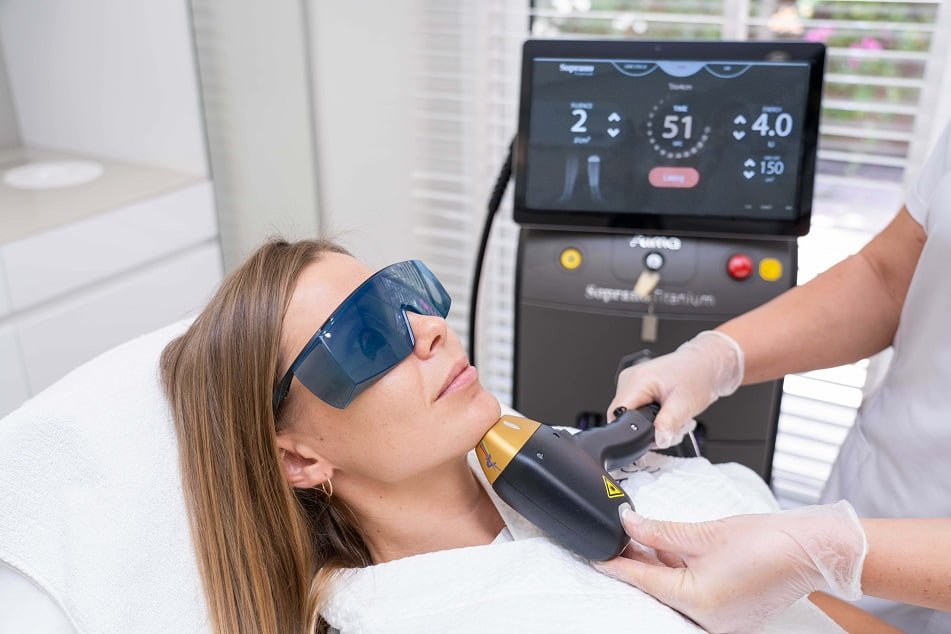 Soprano Titanium laser hair removal treatment