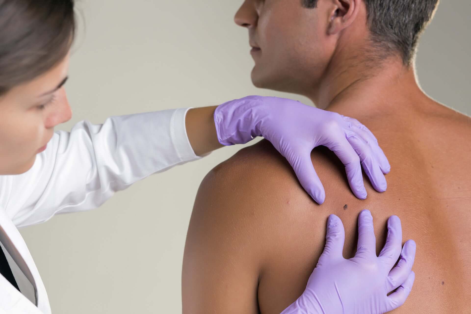 Mole and skin lesions checks by the expert dermatologists - get regular checks of moles and skin lesions on your entire body for healthy-looking and clear skin.