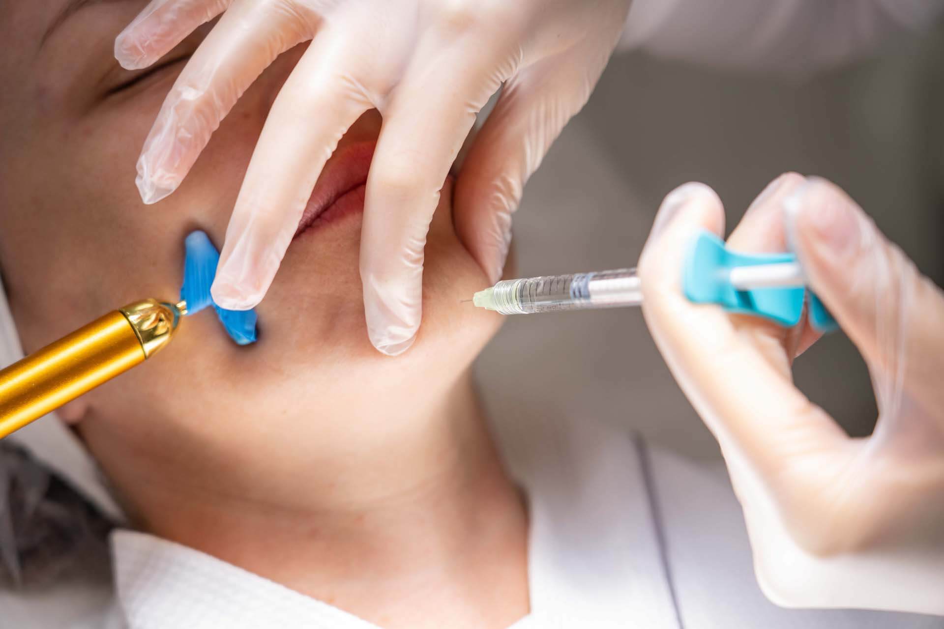 Skin boosters, the advanced skin regeneration injectables - refresh, smooth out and heal your skin and resolve your skin concerns with different skin boosters.