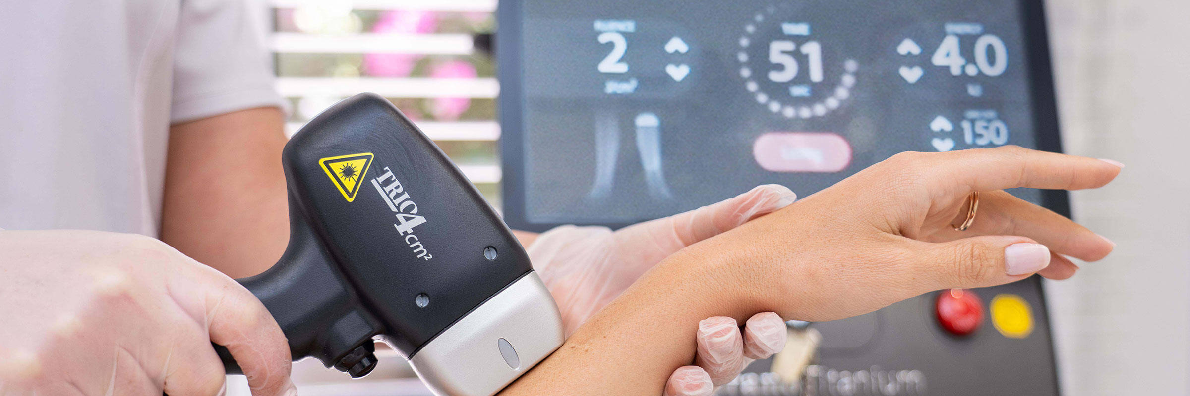 Soprano Titanium the latest laser hair removal treatment