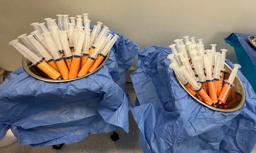 Fat grafting and liposuction surgery equals double benefit - explore the benefits of these two procedures that trim one area of your body and enhance the other.