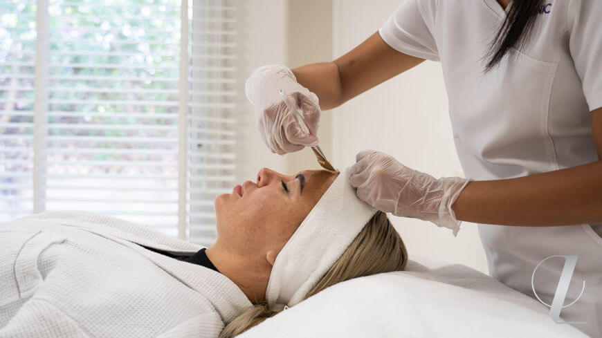 Chemical peels for flawless facial skin of future brides