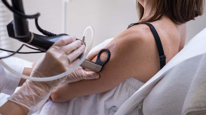 Lucia Clinic’s laser skin resurfacing for glowing skin