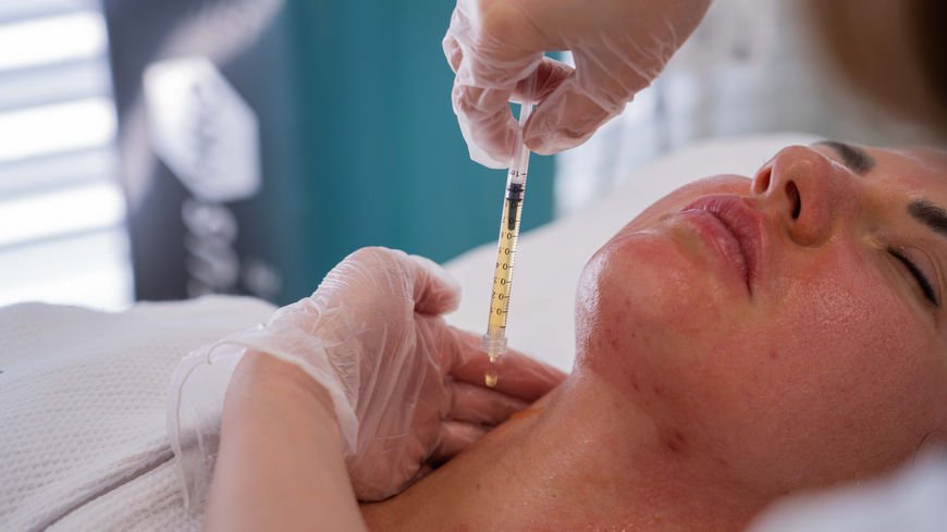 PRP - The Lucia clinic solution for natural skin rejuvenation