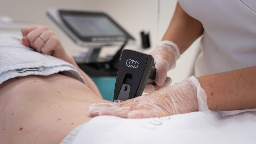 Lucia Clinic’s body contouring with Morpheus8 treatment
