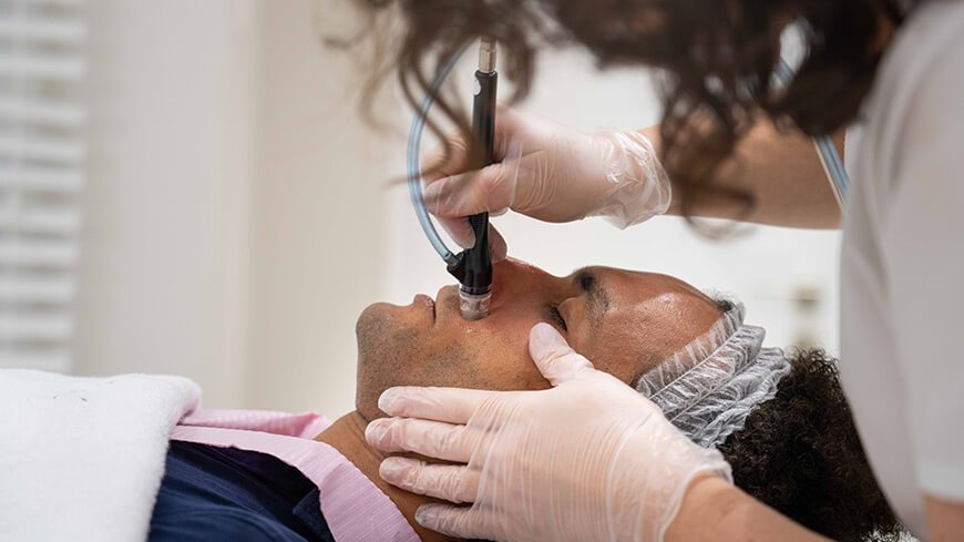 Microdermabrasion for bright and beautiful skin complexion